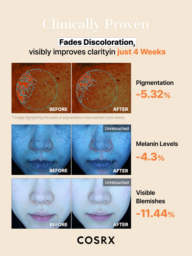 COSRX The Alpha-Arbutin Discoloration Care Hydrogel Mask - Image 7