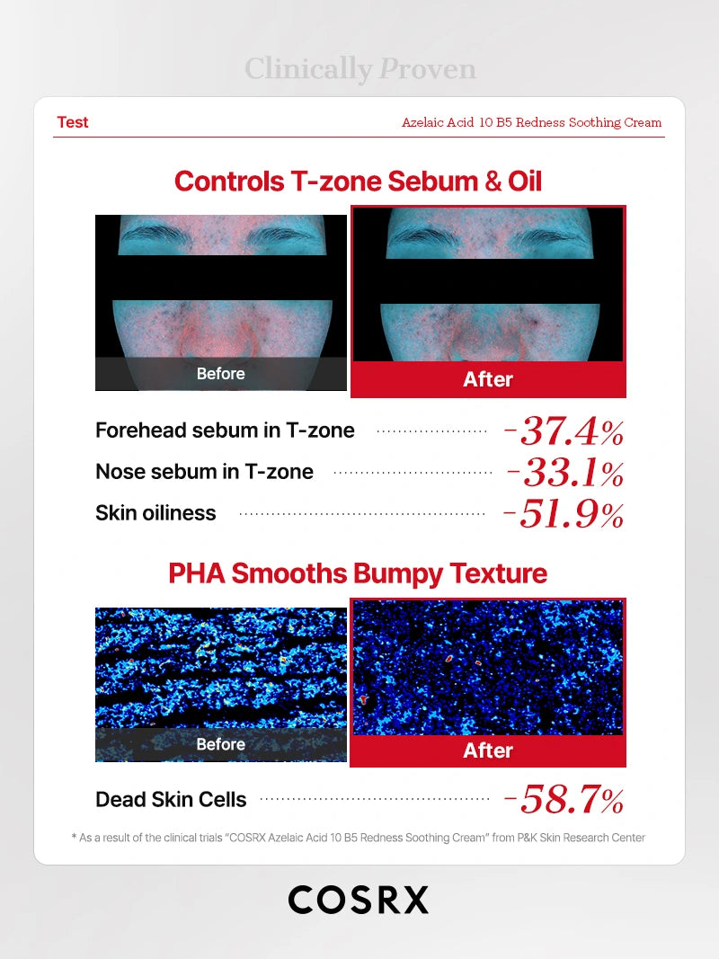 COSRX Azelaic Acid 10 B5 Redness Soothing Cream - Image 7