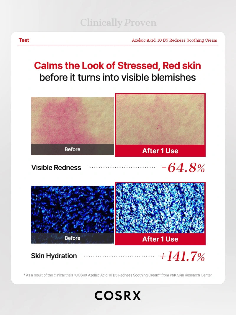 COSRX Azelaic Acid 10 B5 Redness Soothing Cream - Image 8
