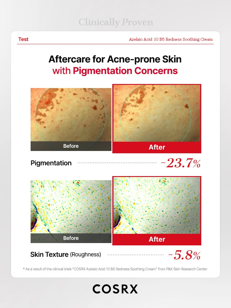 COSRX Azelaic Acid 10 B5 Redness Soothing Cream - Image 10
