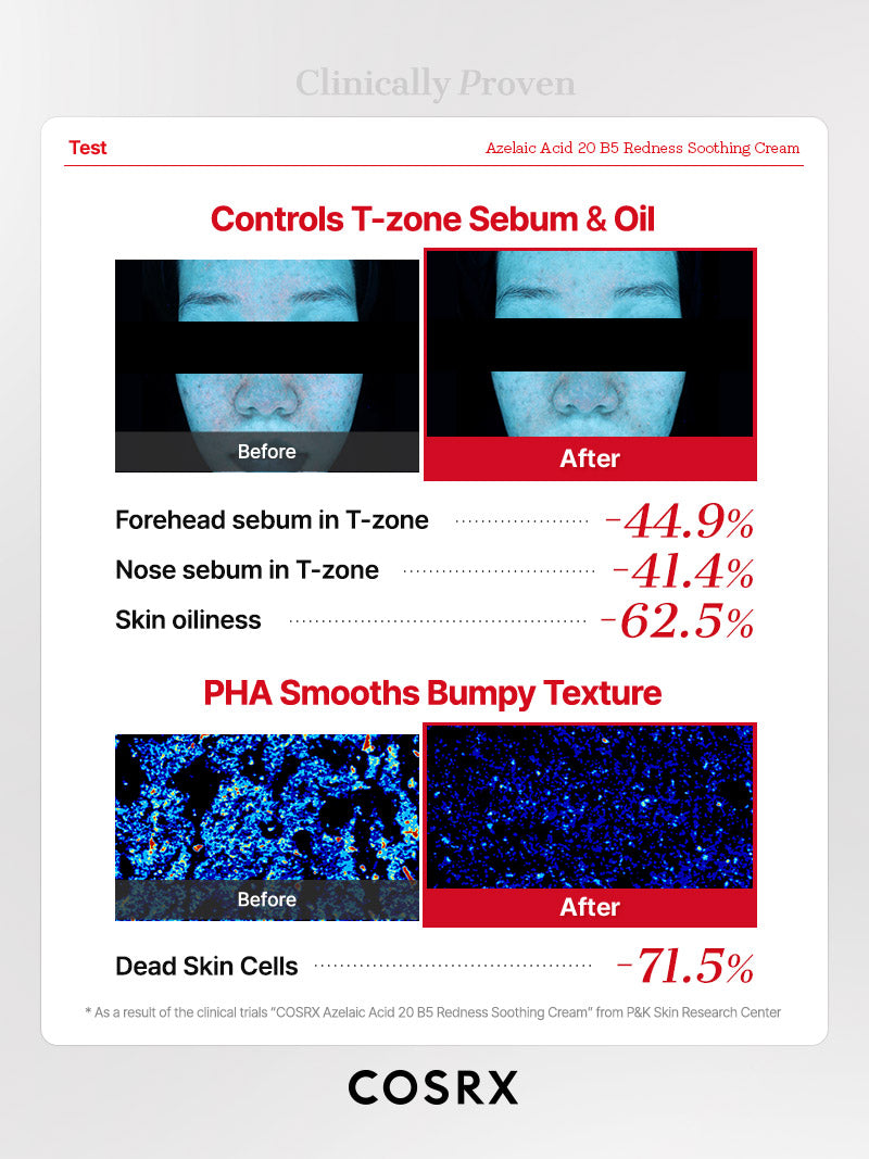 COSRX Azelaic Acid 20 B5 Redness Soothing Cream - Image 7