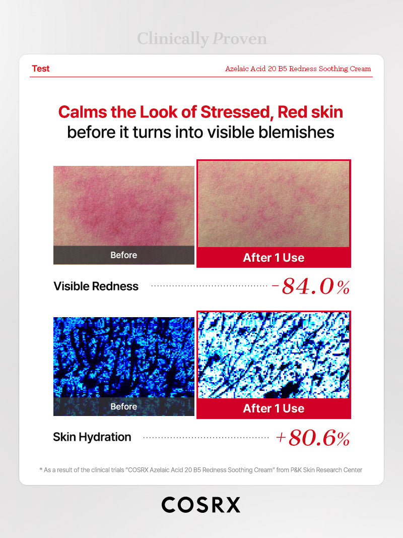 COSRX Azelaic Acid 20 B5 Redness Soothing Cream - Image 8