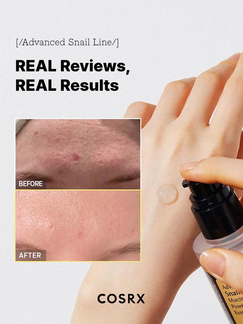 Advanced Snail 96 Mucin Power Essence - Image 6